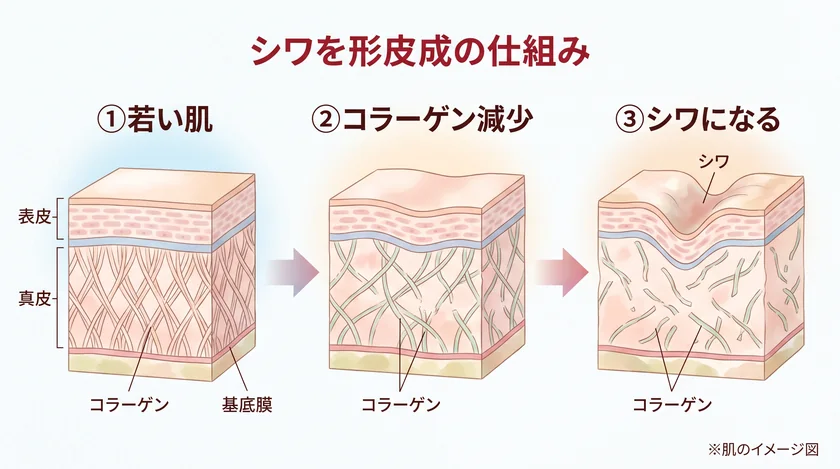 シワができるメカニズムの図解