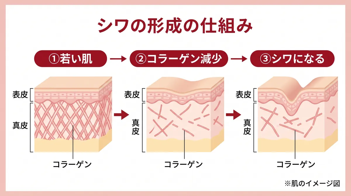 シワができるメカニズムの図解