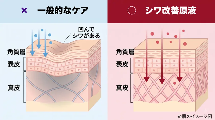 肌の断面図と真皮層へのアプローチ図解